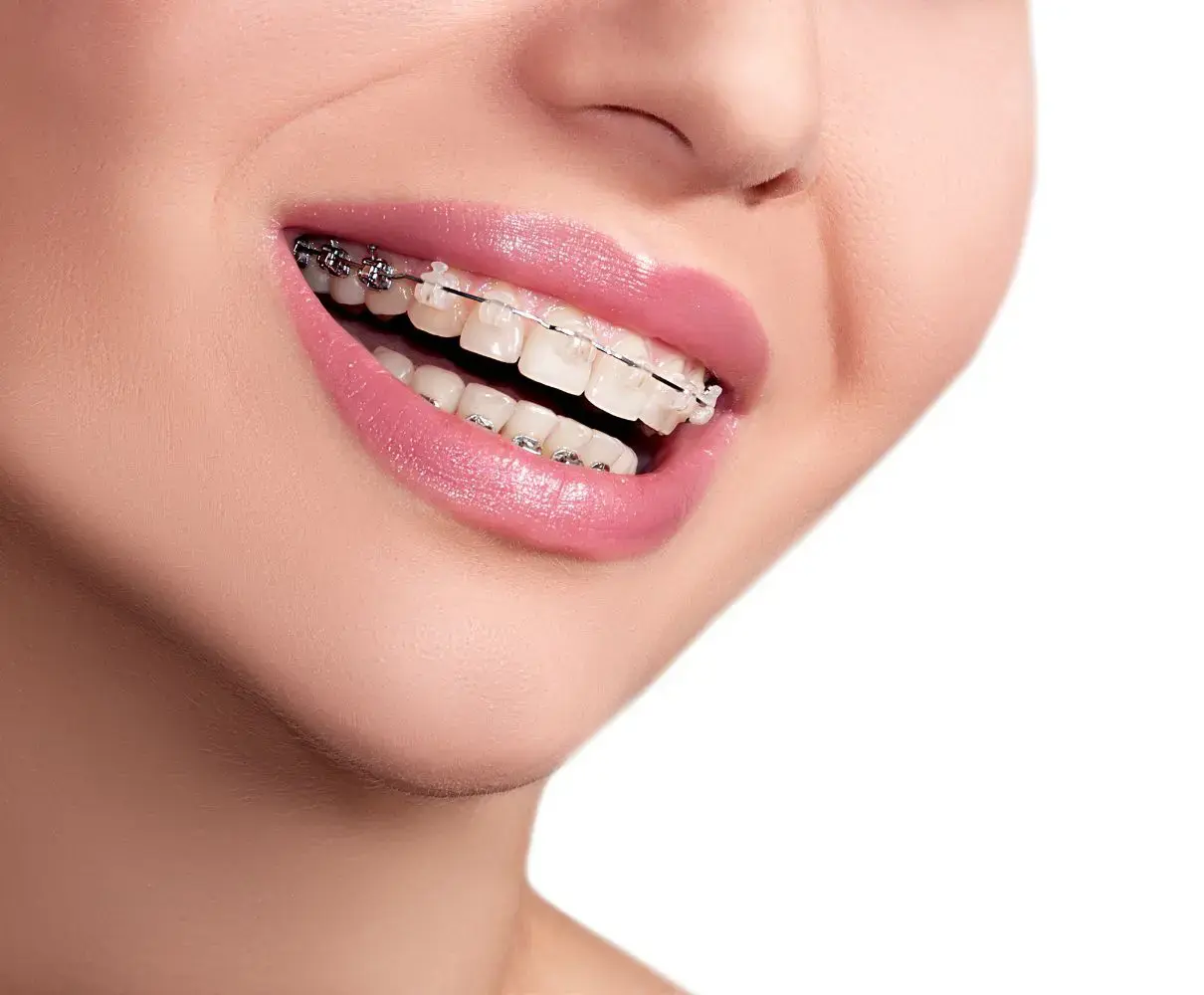متخصص ارتودنسی در حال بررسی پیشبند دندانی برای یک بیمار