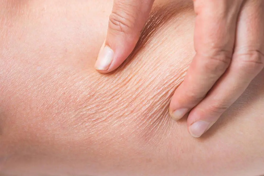 پوست خشک چیست و چگونه از آن مراقبت کنیم؛ بررسی نکات و جزئیات مهم