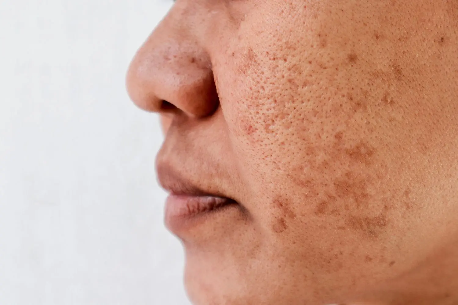 چه زمانی برای مشکلات پوستی به متخصص پوست مراجعه کنیم؛ نکات مهم و کاربردی