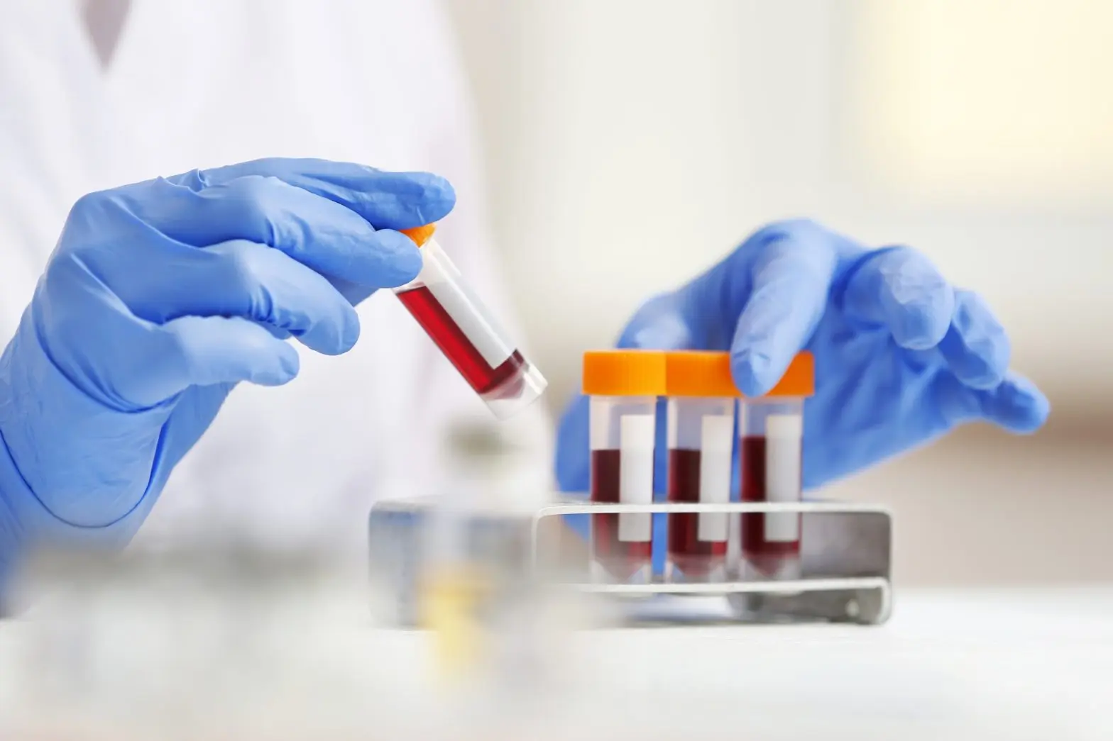 پزشک در حال بررسی نتایج آزمایش خون با بیمار