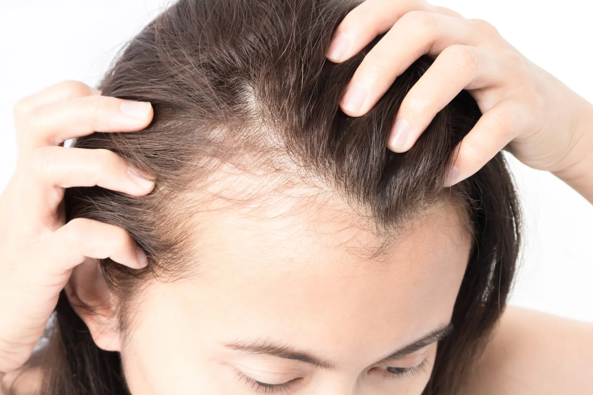 چه زمانی ریزش مو نیاز به بررسی پزشکی دارد؛ راهنمای ساده برای شروع