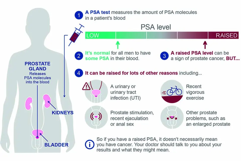 توضیح گرافیکی آزمایش PSA برای تشخیص سرطان پروستات