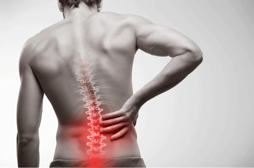 دیسک کمر چیست و چه علائمی دارد؛ راهنمای ساده برای شروع