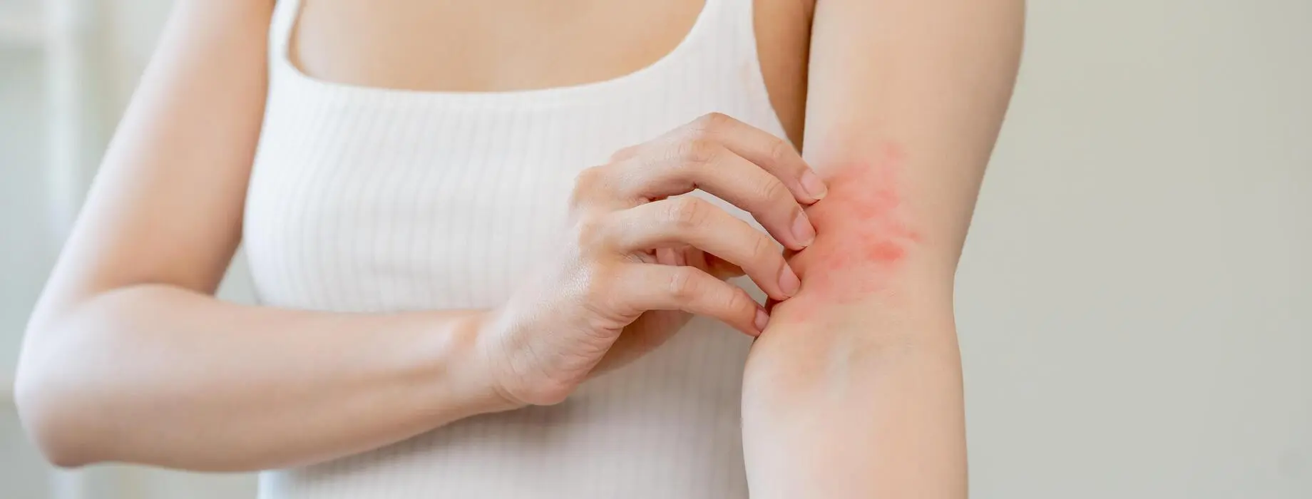 خارش و بثورات پوستی در واکنش آلرژیک