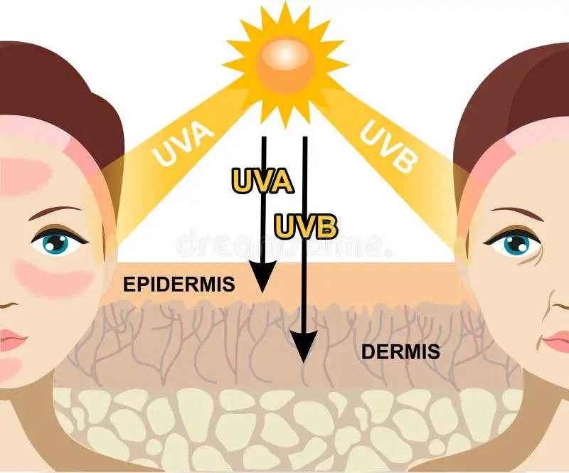 نمودار مقایسه‌ای اثرات اشعه UVA و UVB بر پوست