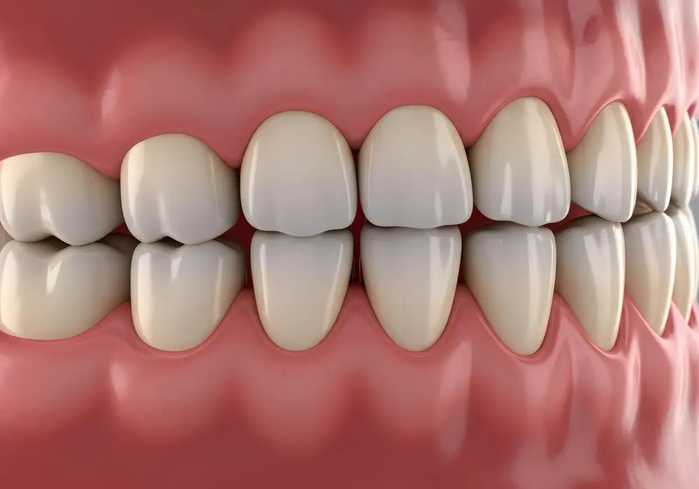دندان‌ها و لثه‌های سالم با بافت طبیعی و بدون التهاب