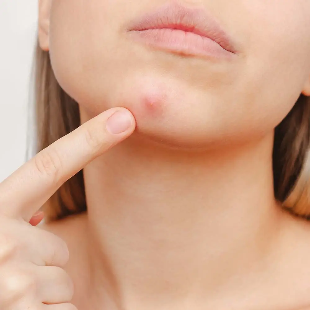 پاکسازی منافذ پوست با استفاده از ماسکهای خاص