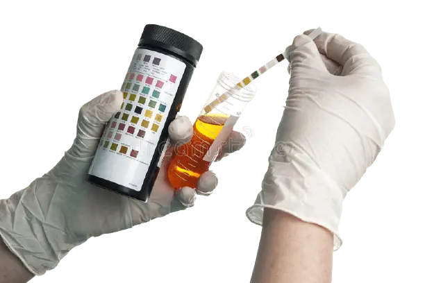 آزمایشگر در حال بررسی نتایج آزمایش ادرار با استفاده از نوارهای آزمایشی